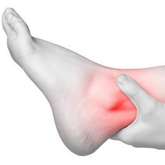 Muscle Strains and Podiatry